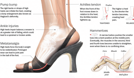 Anatomy of a High Heel & Parts You Need to Know – Footwear News